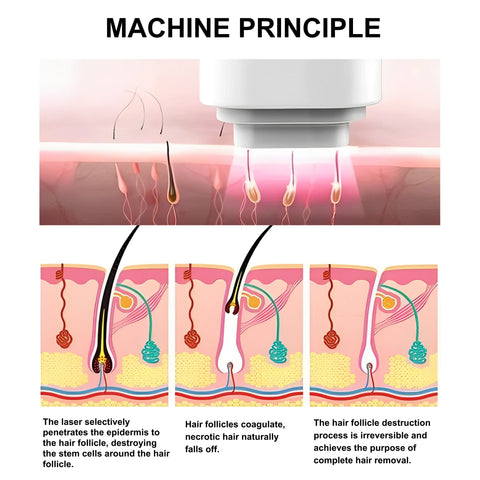 808 nm-Diode-Laser-For-Hair-Removal-LitePro-2