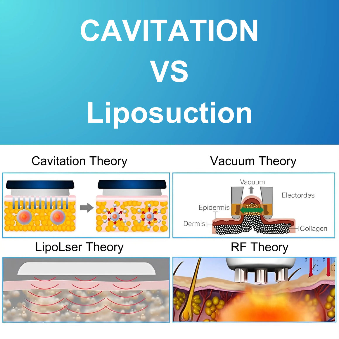 CAVITATION VS Liposuction