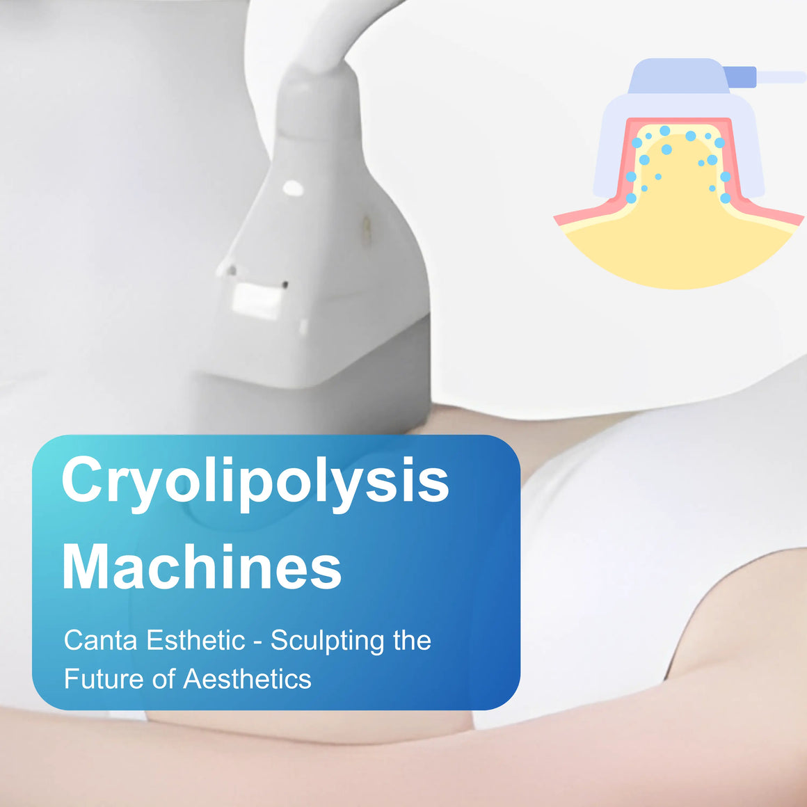 Cryolipolysis Machines