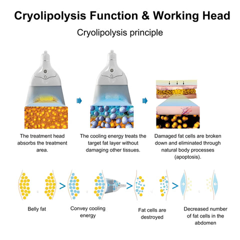 Cryolipolysis-Fat-Freezing-Machine-Zen_2