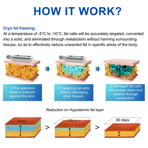 Cryotherapy-Mahine-with-Cryo-Boards_2