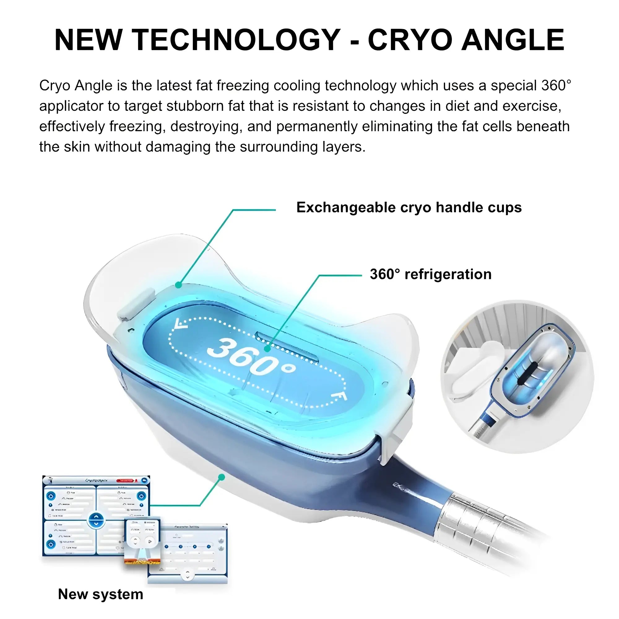 Portable Cryolipolysis Machine X360