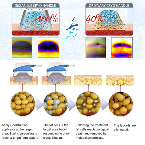 Portable Cryolipolysis Machine X360