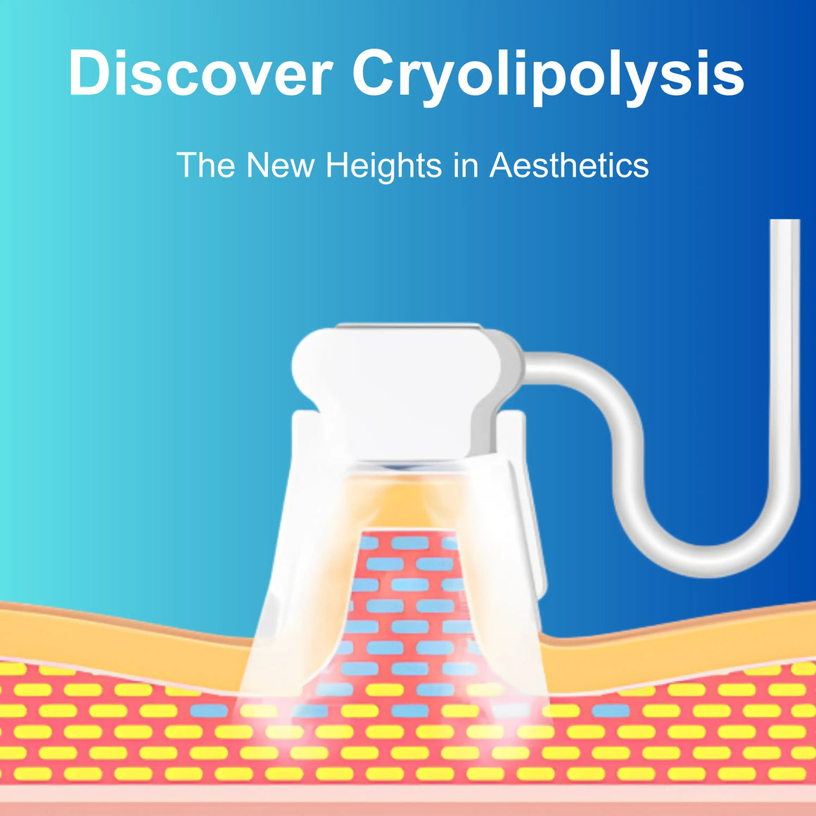 Discover Cryolipolysis