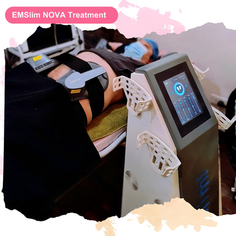 EMSlim NOVA Body Sculpting Treatment