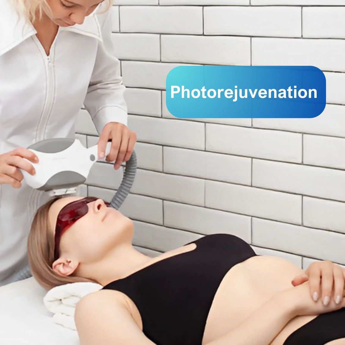 Ipl Opt Machine Photorejuvenation
