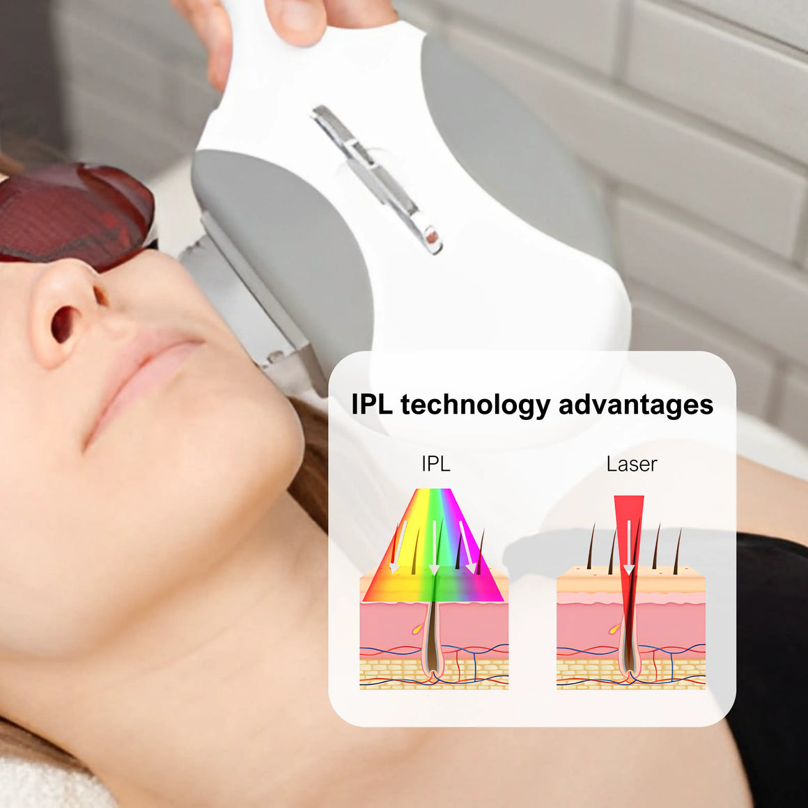 Ipl Opt Machine What We Recommend: Advanced IPL technology——broad-spectrum light energy ...