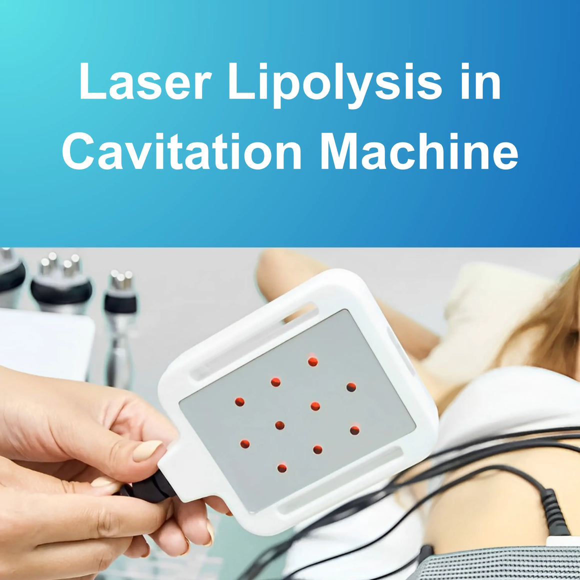 Laser Lipolysis in Cavitation Machine