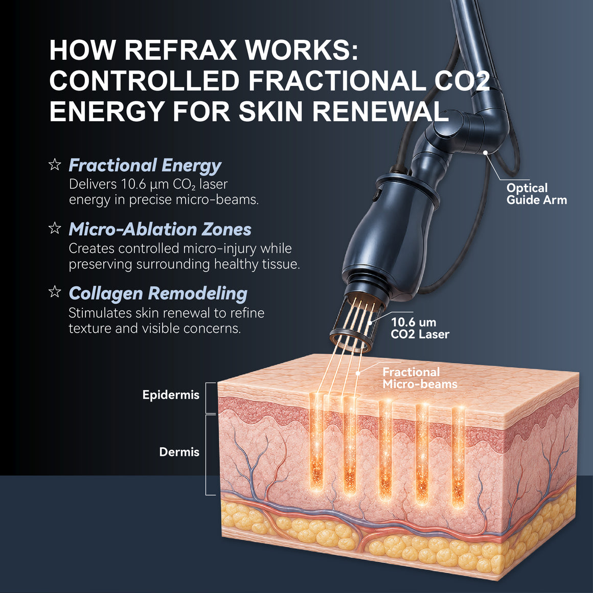 Refrax How ReFrax Works: Controlled Fractional CO₂ Energy for Skin Renewal